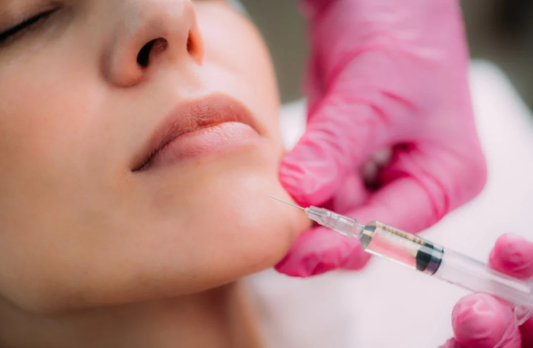 Dermal filler treatment being administered to the lower face